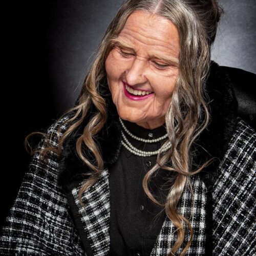 Prothetics by Neha Gallery Image